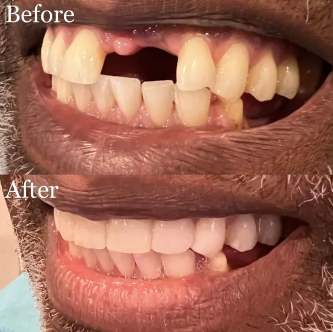 RR Smiles | Cosmetic Dentist in San Diego Picture 8