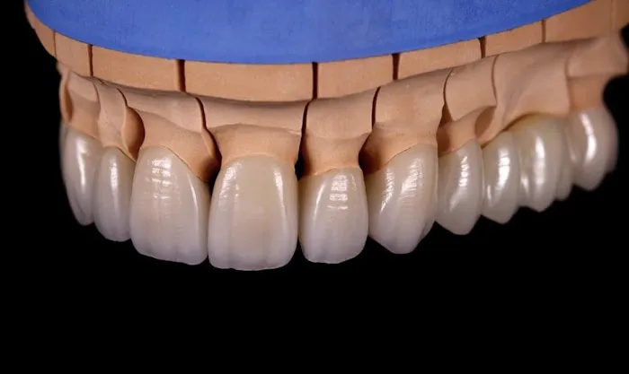 RR Smiles | Cosmetic Dentist in San Diego Picture 3