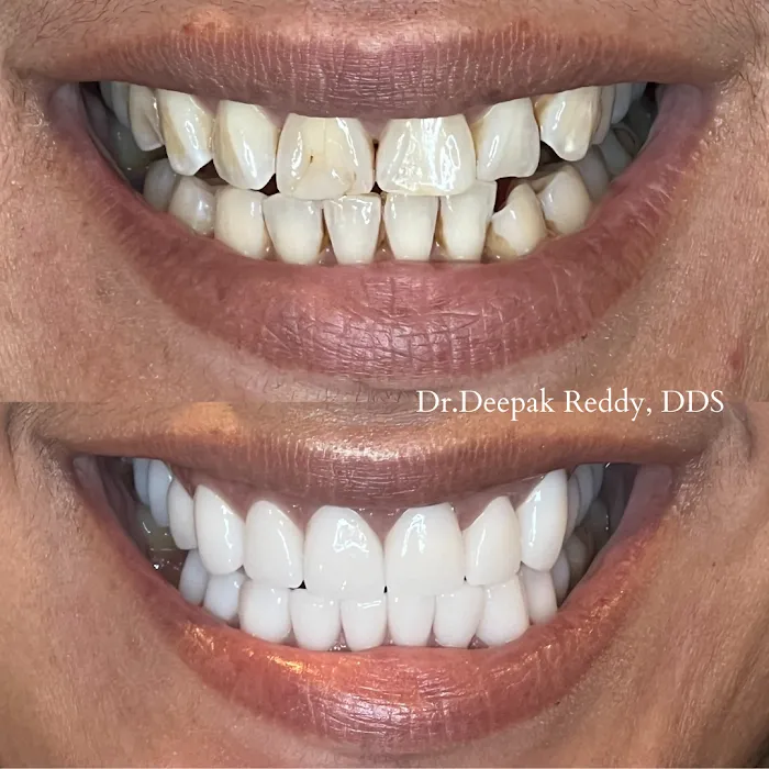 RR Smiles | Cosmetic Dentist in San Diego Picture 9
