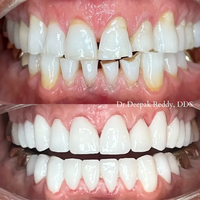 RR Smiles | Cosmetic Dentist in San Diego Picture 10