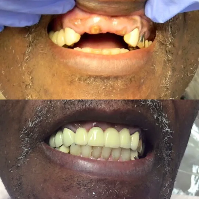 Bedir Family Advanced Laser & Implant Dentistry Picture 6