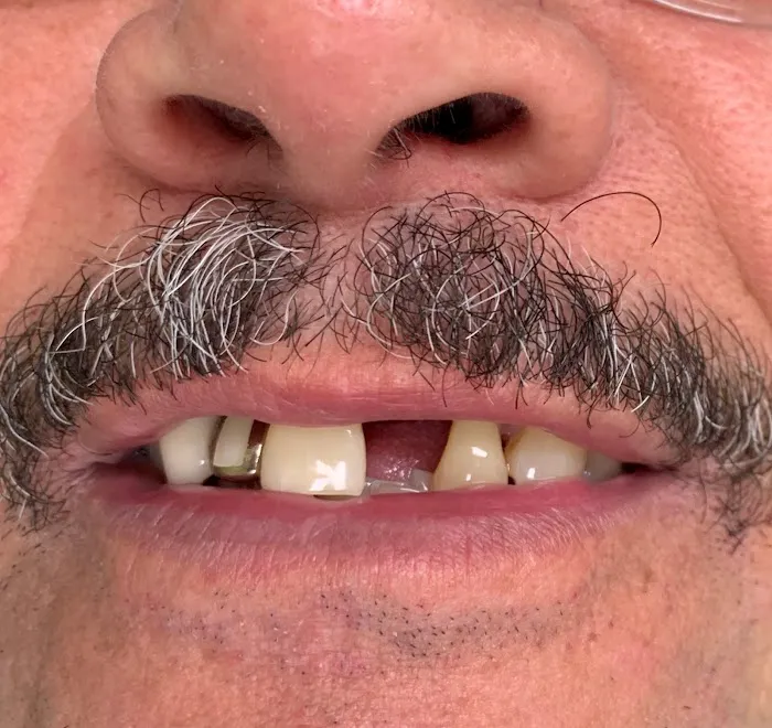 Ridge Road Family Dentistry Picture 10