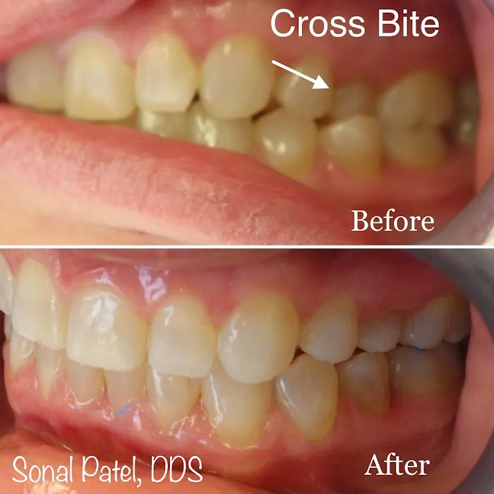 Patel Sonal DDS Picture 5