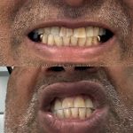 Evans Signature Dentistry