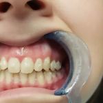 Dr Harsimran Chadha DDS