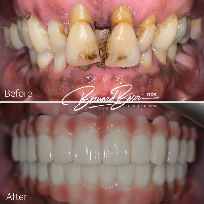 Smile Recreation Dentistry Picture 4