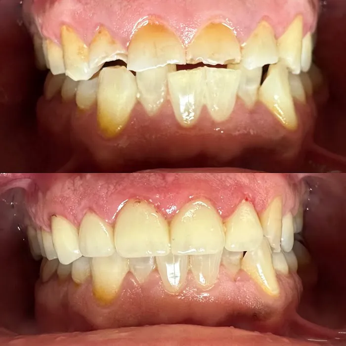 Gentle Family Dental and Braces of East Los Angeles Picture 10