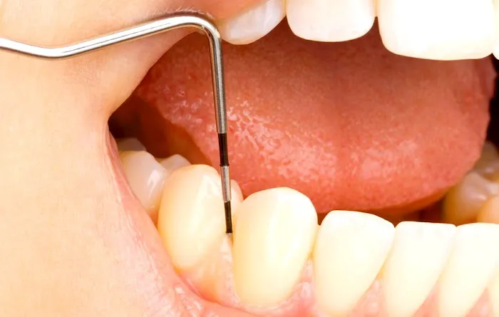 Top Dental of Huntington Park - Dental Implant, General Dentist & Orthodontist Picture 10