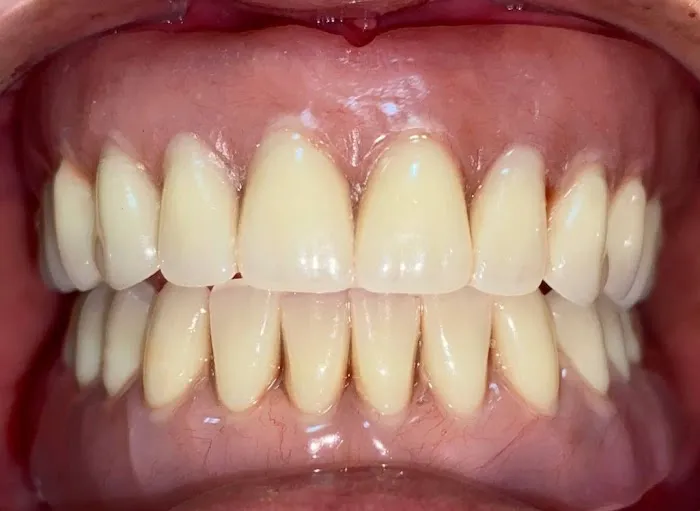 Endodent Picture 6