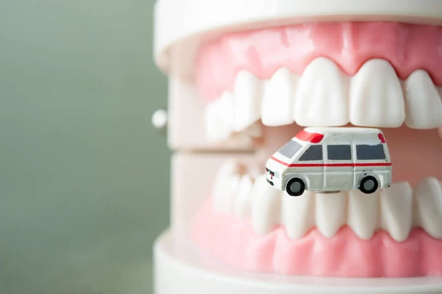 What to Do If Your Tooth Breaks – Quick Guide to Handling a Dental Emergency