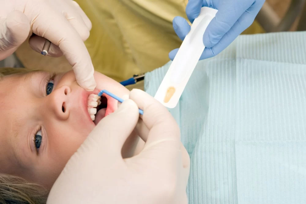 Importance of Fluoride Treatments for Kids and Their Oral Health