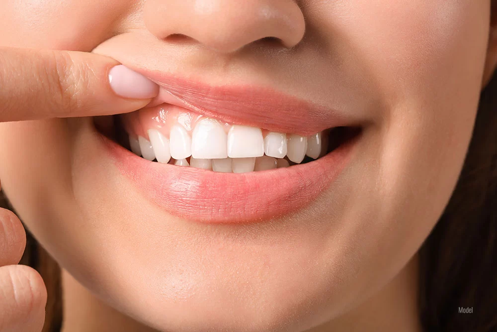Immediate Care for Swollen Gums: Effective Relief and Treatment