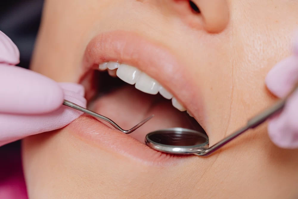 What Happens During a Dental Cleaning Appointment? A Complete Guide