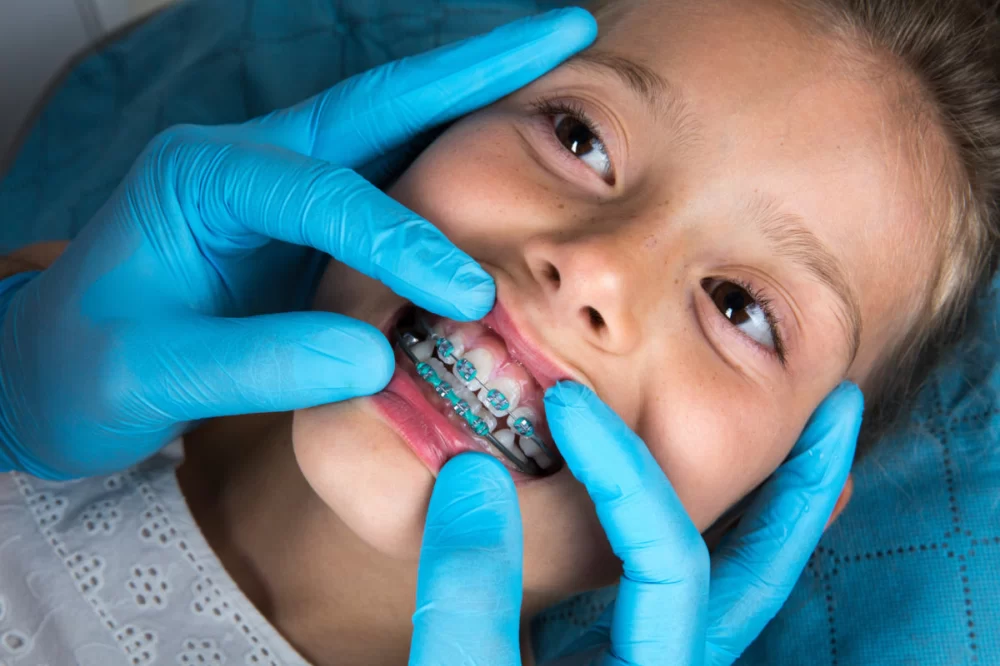 When to Start Orthodontic Care for Kids: A Complete Guide