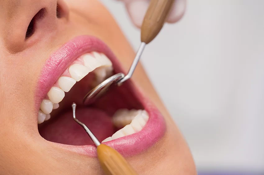 What is Involved in a Dental Cleaning? A Step-by-Step Guide to Professional Teeth Cleaning