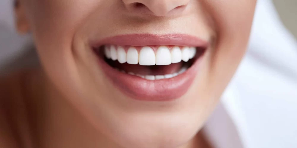 Does Dental Insurance Cover Cosmetic Dentistry? Find Out What’s Covered