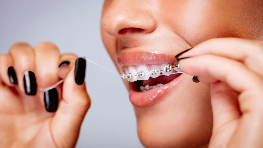 How to Brush Your Teeth Correctly to Prevent Cavities