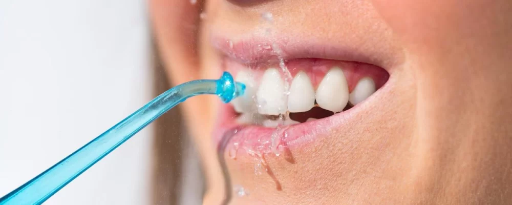 How to Protect Your Teeth from Decay: Essential Tips for Healthy Teeth