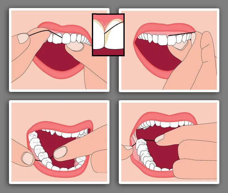 How to Avoid Tooth Decay with Proper Flossing Techniques