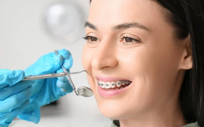 The Best Time to Get Braces: When to Start Treatment for a Perfect Smile