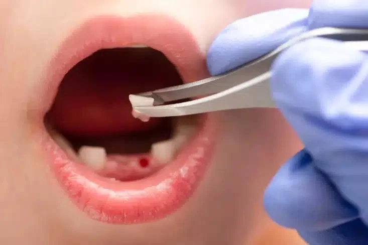 How to Prepare for a Dental Procedure: Essential Tips for a Smooth Experience