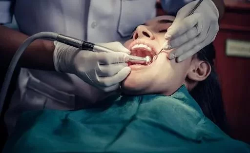 What is Dental Insurance and How Does It Work in the USA?