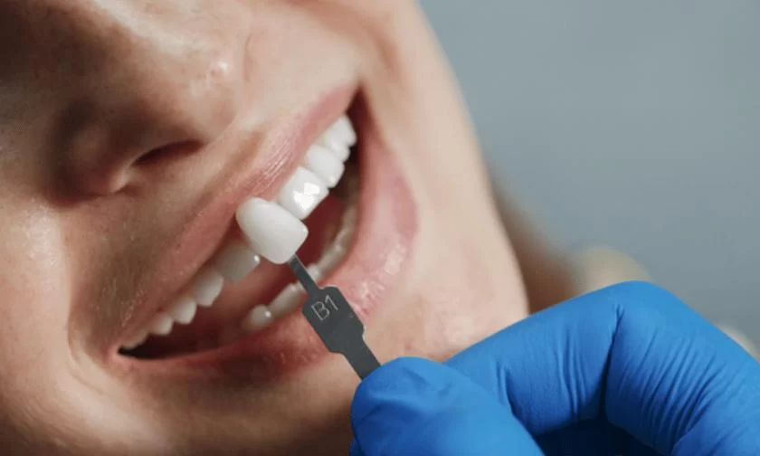 How to Protect Your Gums from Recession: Essential Tips for Healthy Gums