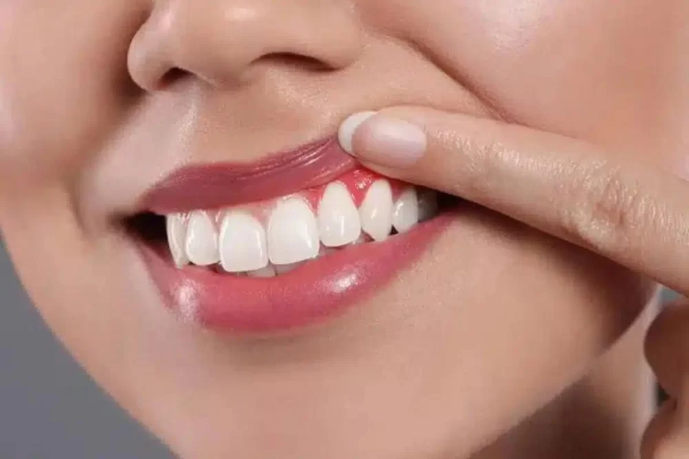 Understanding the Link Between Gum Disease and Heart Problems: What You Need to Know