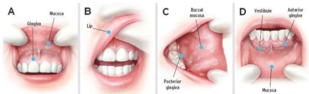 How to Identify Oral Cancer Early Signs: A Comprehensive Guide for Early Detection