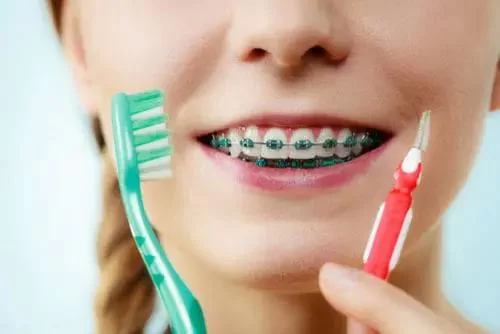 Best Dental Care Routine for Adults with Braces: Expert Tips for a Healthy Smile