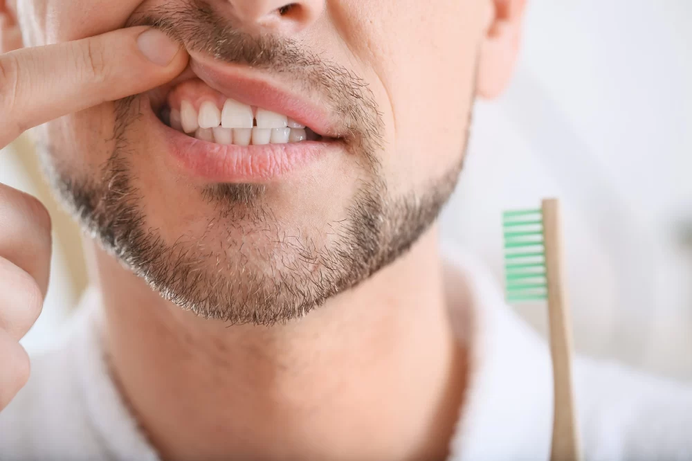 The Effects of Alcohol on Oral Health: What You Need to Know