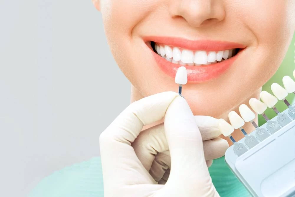 Effects of Teeth Whitening on Sensitive Teeth: What You Need to Know