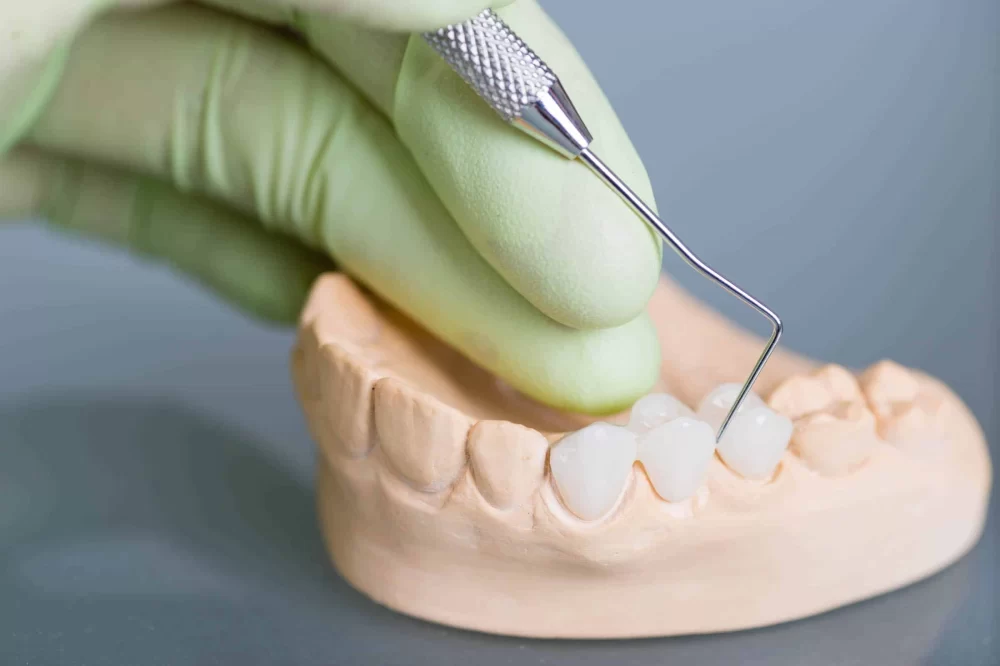 Understanding the Importance of Dental Bridges for Tooth Restoration