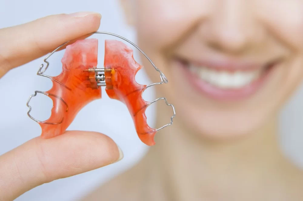 How to Maintain Dental Health While Wearing Retainers