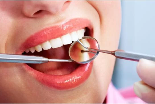 Benefits of Dental Bonding: A Comprehensive Guide to Tooth Bonding Procedure