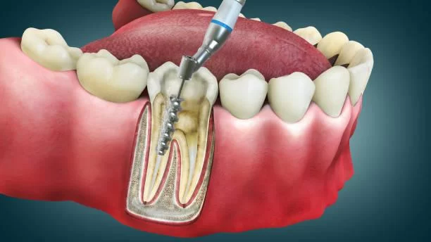 How to Prevent Bad Breath and Improve Your Oral Health