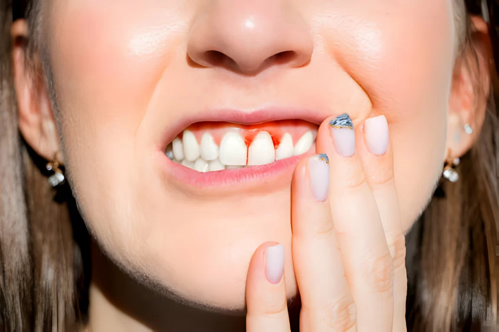 Effective Gum Disease Treatment: Comprehensive Guide to Restoring Your Oral Health