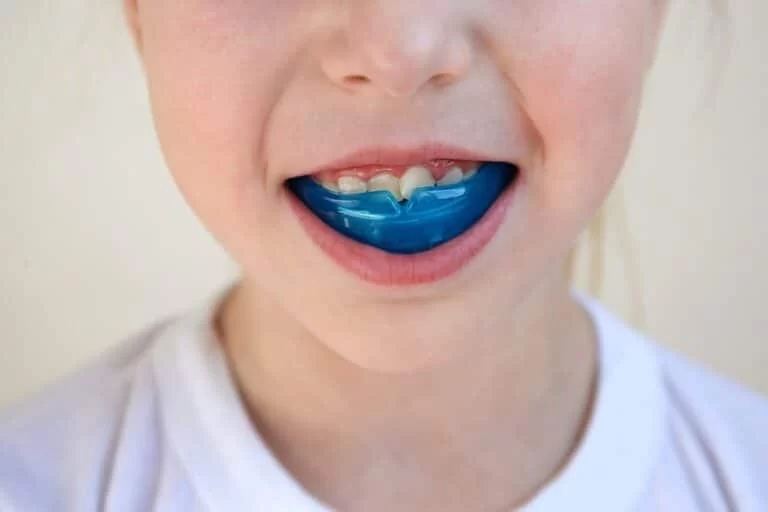 Why Wearing a Mouthguard During Sports Activities is Essential for Your Safety