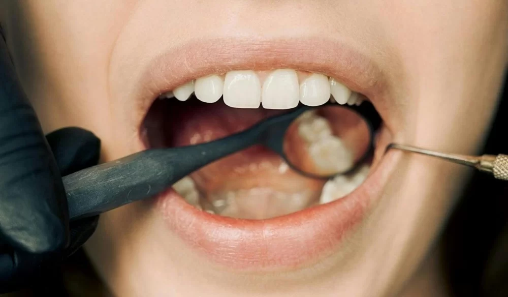 How to Prevent Mouth Sores from Dental Treatments: Essential Tips and Advice