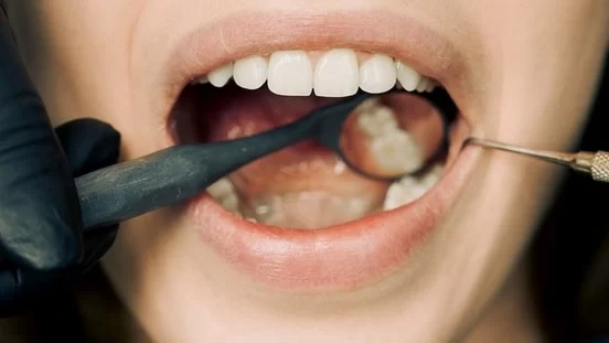 How to Care for Your Teeth After Oral Surgery – Recovery Tips for Long-Term Oral Health