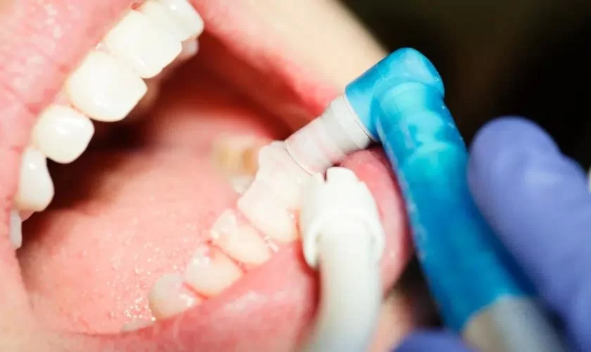 How to Prevent Gum Disease with Regular Dental Cleanings