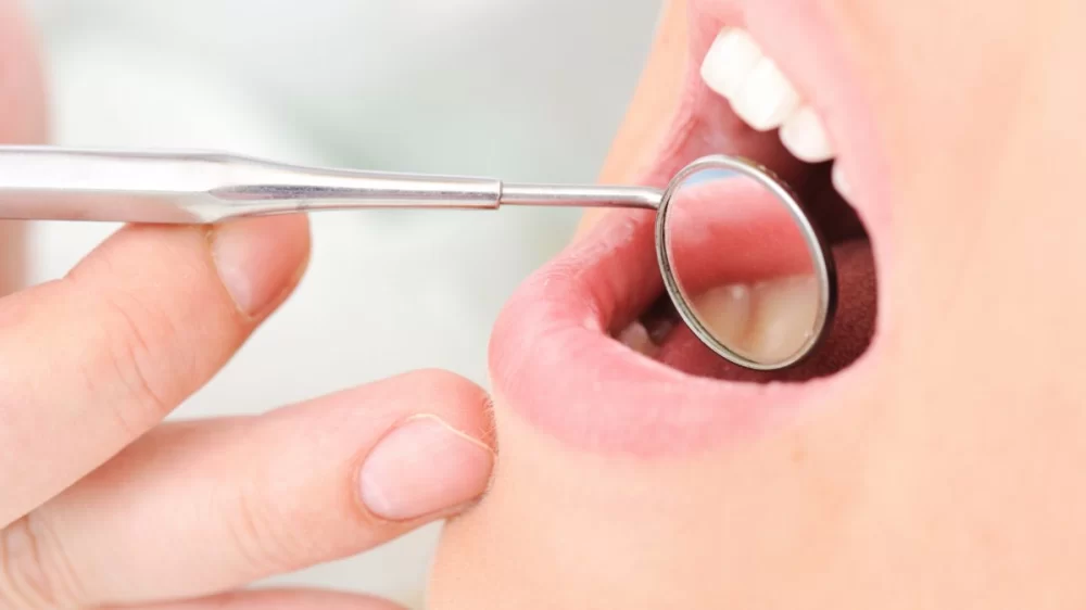 How to Deal with Tooth Pain After a Dental Filling – Practical Tips and Relief Solutions