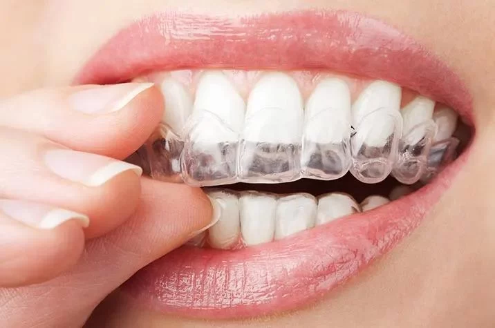 How to Manage Sensitive Teeth During Winter – Practical Tips for Cold Weather Dental Care