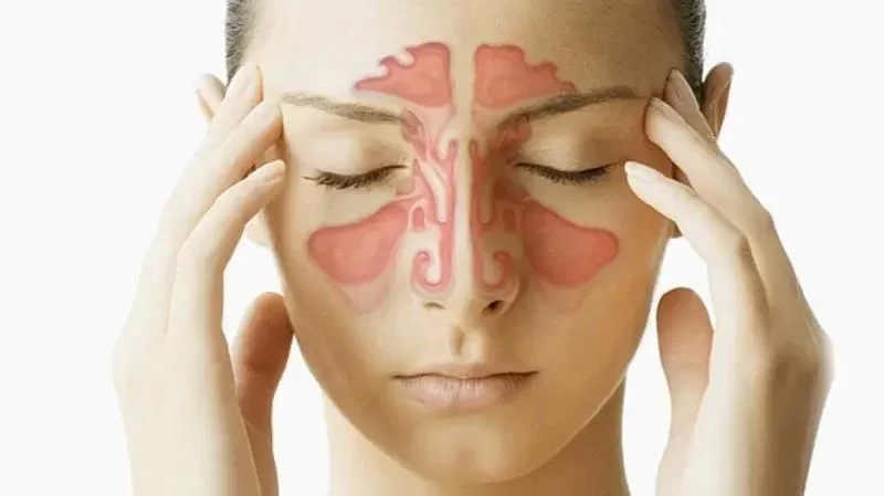 How to Treat Tooth Pain Caused by a Sinus Infection Effectively