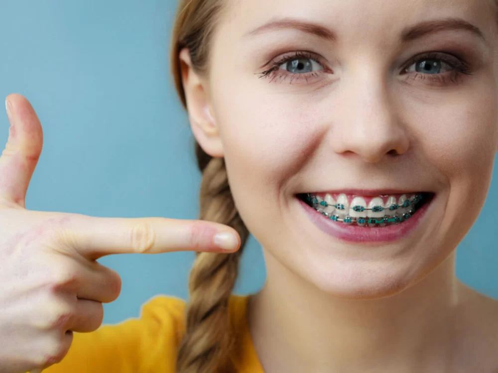 How to Find a Top-Rated Orthodontist for Braces That Meets Your Needs