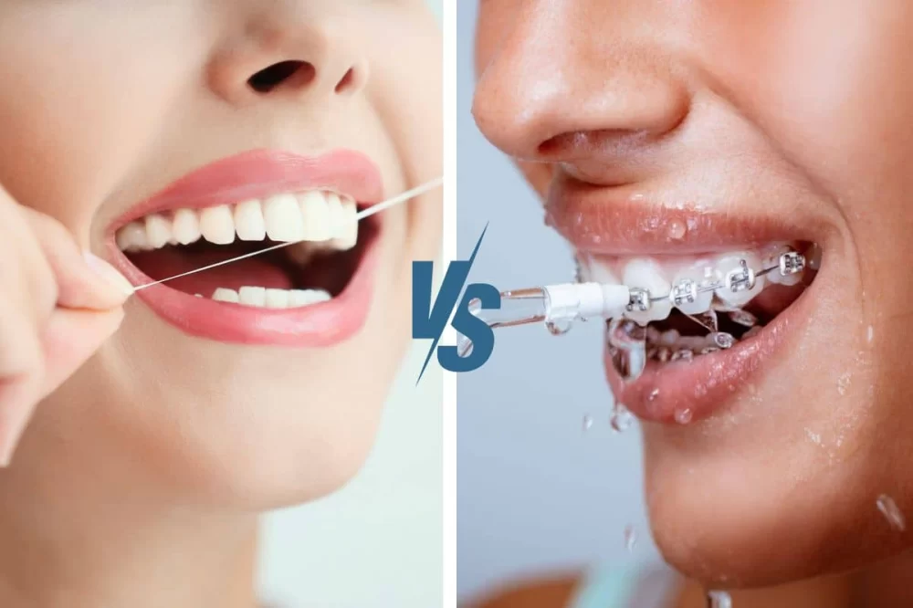 Why Daily Flossing is Essential for Maintaining Healthy Teeth and Gums