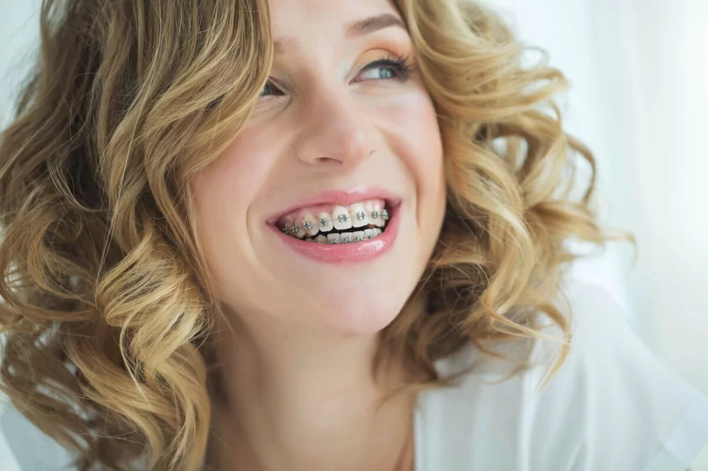Best Dental Care Routine for Adults with Braces: Effective Tips for Healthy Teeth