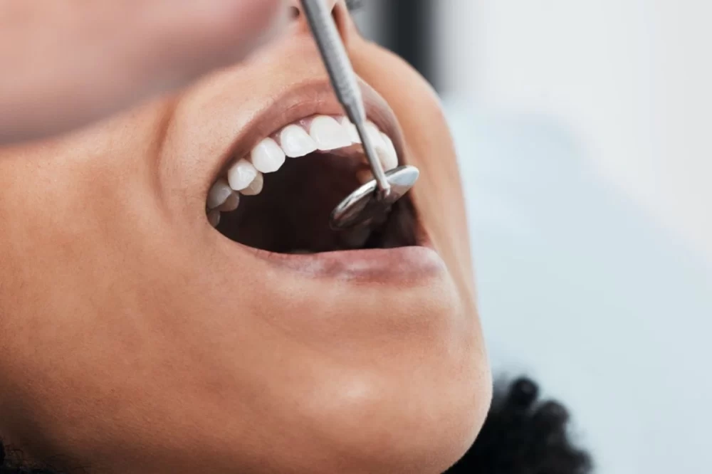 How to Fix Uneven Gums Naturally: Practical Tips and Effective Remedies