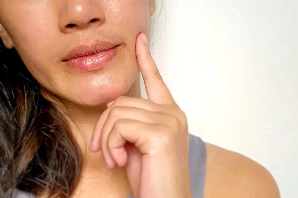 Exploring Causes of Dry Lips Due to Oral Health Issues and How to Manage Them