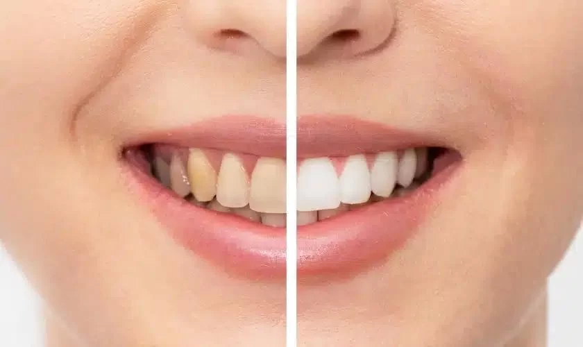 Choosing the Best Toothpaste for Sensitive Teeth and Gums: A Detailed Guide